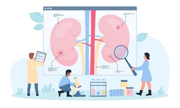 Cartoon illustration of clinical researchers analysing kidneys for chronic kidney disease treatments